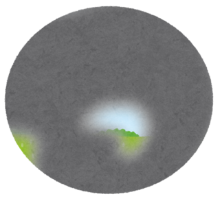 緑内障3.png